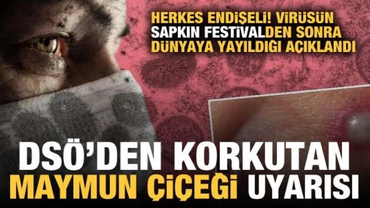 DSÖ'den korkutan maymun çiçeği uyarısı: Virüsün sapkın festivalden yayıldığı açıklandı