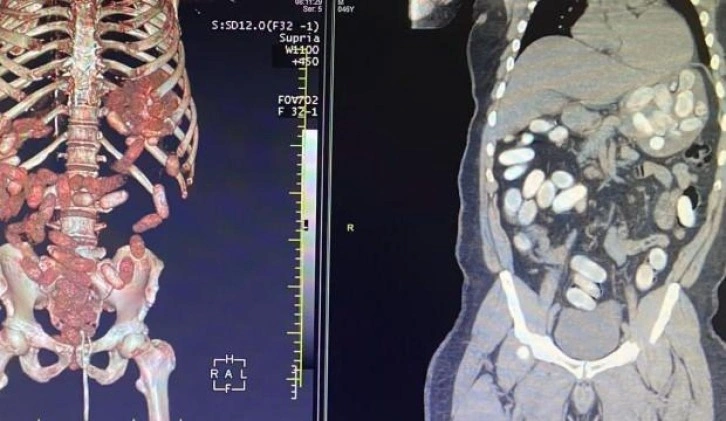 İstanbul Havalimanı’nda uyuşturucu operasyonu:  11 kilo kokain ele geçirildi!