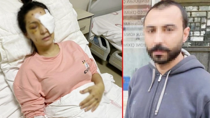 Kendisine "ağabey'" demeyen yengesini, 37 yerinden bıçaklayıp kör etti