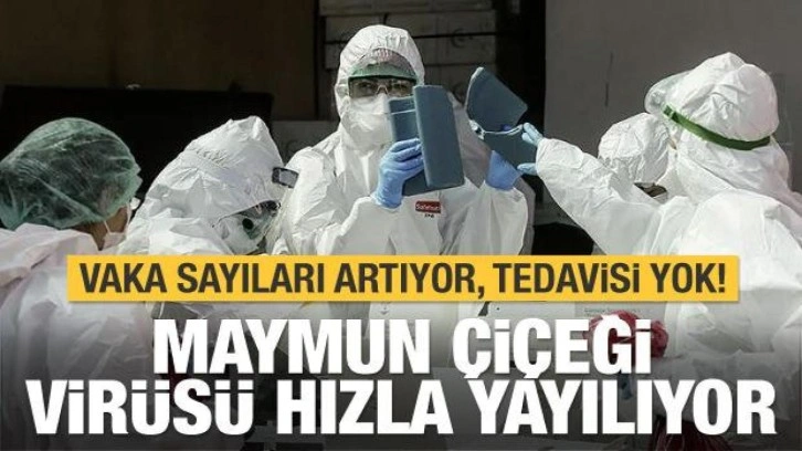 Maymun Çiçeği virüsü nedir, nasıl bulaşır? Belirtileri ve korunma yöntemleri belli oldu