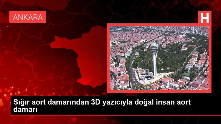 Sığır aort damarından 3D yazıcıyla doğal insan aort damarı üretildi