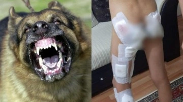 Başıboş köpek terörü bitmek bilmiyor! Küçük çocuğa dehşeti yaşattılar