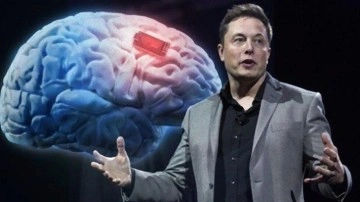 Elon Musk tarih verdi... İlk defa bir insan üzerinde deneyecekler!