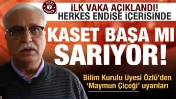 İlk vaka sonrası Bilim Kurulu üyesi Tevfik Özlü'den Maymun Çiçeği uyarısı