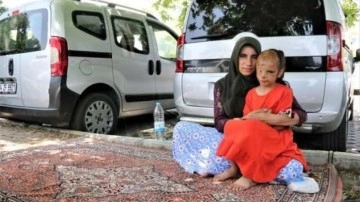 İzmir'de yüzü yanan 6 yaşındaki Dilara'ya, Sağlık Bakanlığı el uzattı