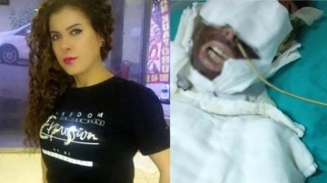 Kadına kimyasal sıvı ile saldırmıştı. İstanbul'daki vahşetin cezası belli oldu: 20 yıl hapis