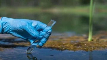 Kolera hastalığı belirtileri? Kolera virüsü insandan insana bulaşır mı? Türkiye'de kolera