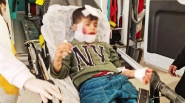 Köpeklerin saldırısına uğrayan 7 yaşındaki Ahmet, ağır yaralandı