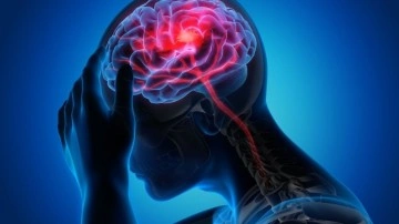 Migren neden olur. Migren ağrısına ne iyi gelir. Migren belirtileri nelerdir. Sinüzit migren nedir?