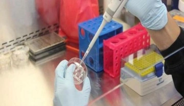 Türkiye, PCR ve hızlı tanı testi üretiminde üçüncü sırada