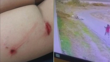 Yine sokak köpeği dehşeti. 9 yaşındaki çocuğa böyle saldırdı. Yaralı çocuk hastaneye kaldırıldı